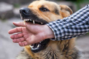 dog biting a man's hand due to someone else's negligence