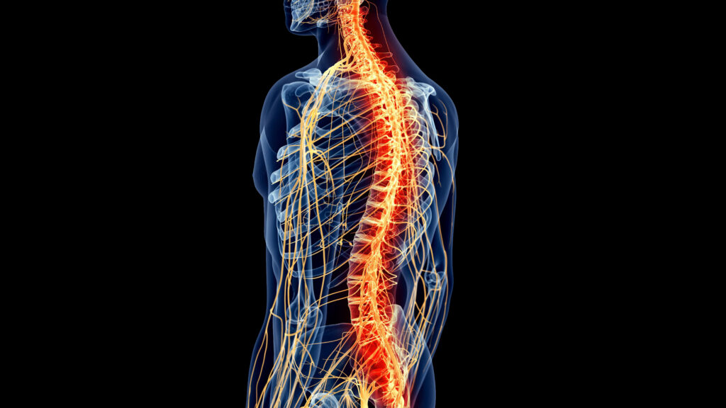 Spinal Injury Lawyer