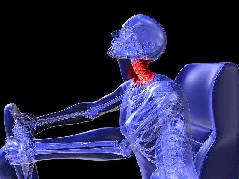 neck pain after car accident connecticut