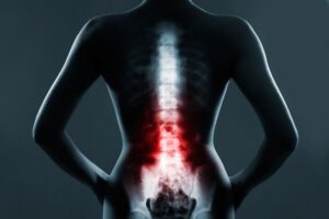 Spinal Cord Injuries