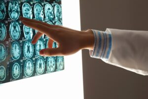 brain injury lawyer Waterbury, CT