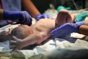 birth injury lawyer in Waterbury, CT